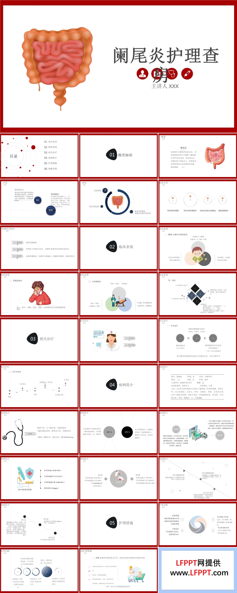 阑尾炎ppt课件