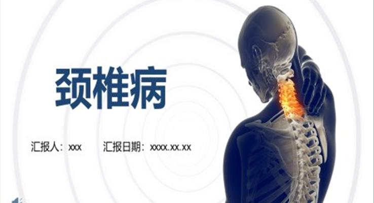 颈椎病护理查房PPT