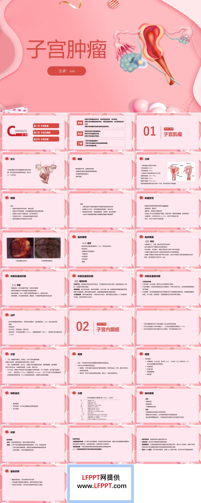 子宫肿瘤妇产科学课件ppt模板