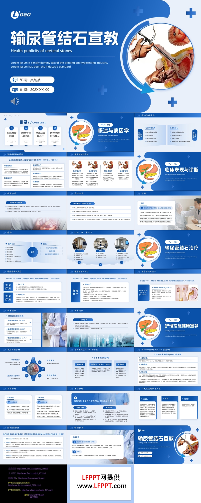 输尿管结石健康宣教PPT含讲稿