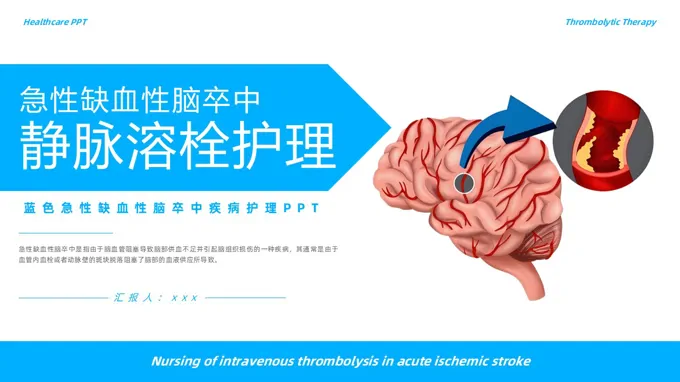 急性缺血性脑卒中静脉溶栓护理PPT含讲稿