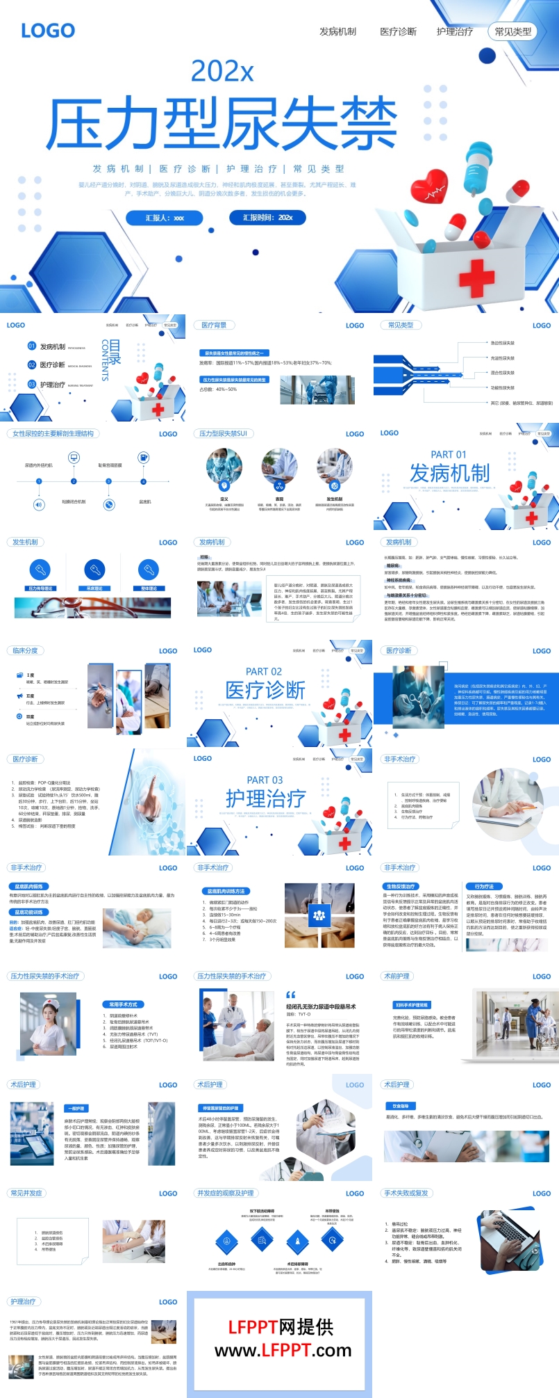 压力性尿失禁护理ppt