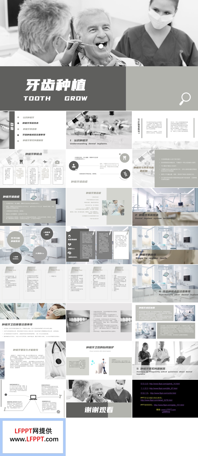 种植牙ppt课件含讲稿